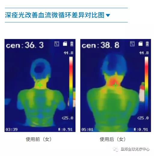 颈椎亚健康有多要命?很危险!(图7) 颈椎亚健康有多要命?很危险!(图7)