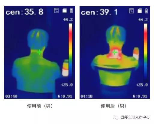 颈椎亚健康有多要命?很危险!(图8) 颈椎亚健康有多要命?很危险!(图8)